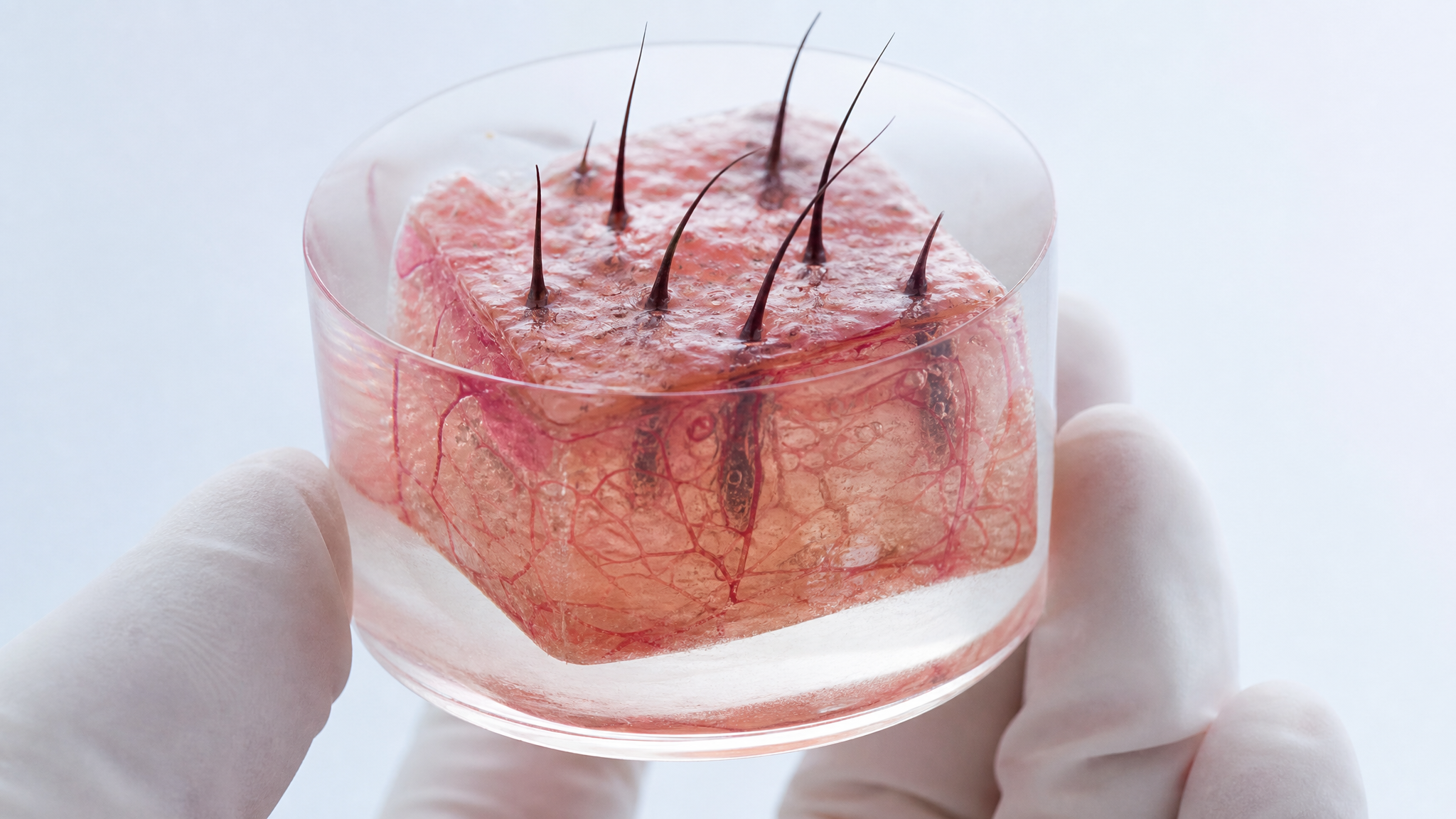 Skin & Grafts